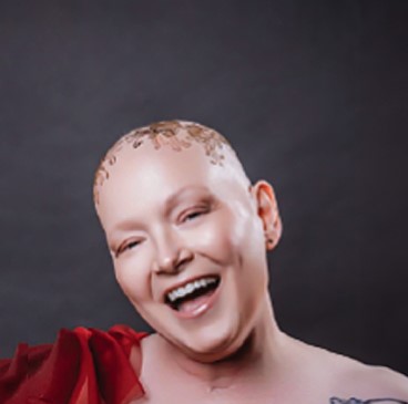 Tanya, a woman receiving TRODELVY, sits smiling at the camera. Tanya is a White woman with no hair and henna tattoos on her head, wearing a red shirt.